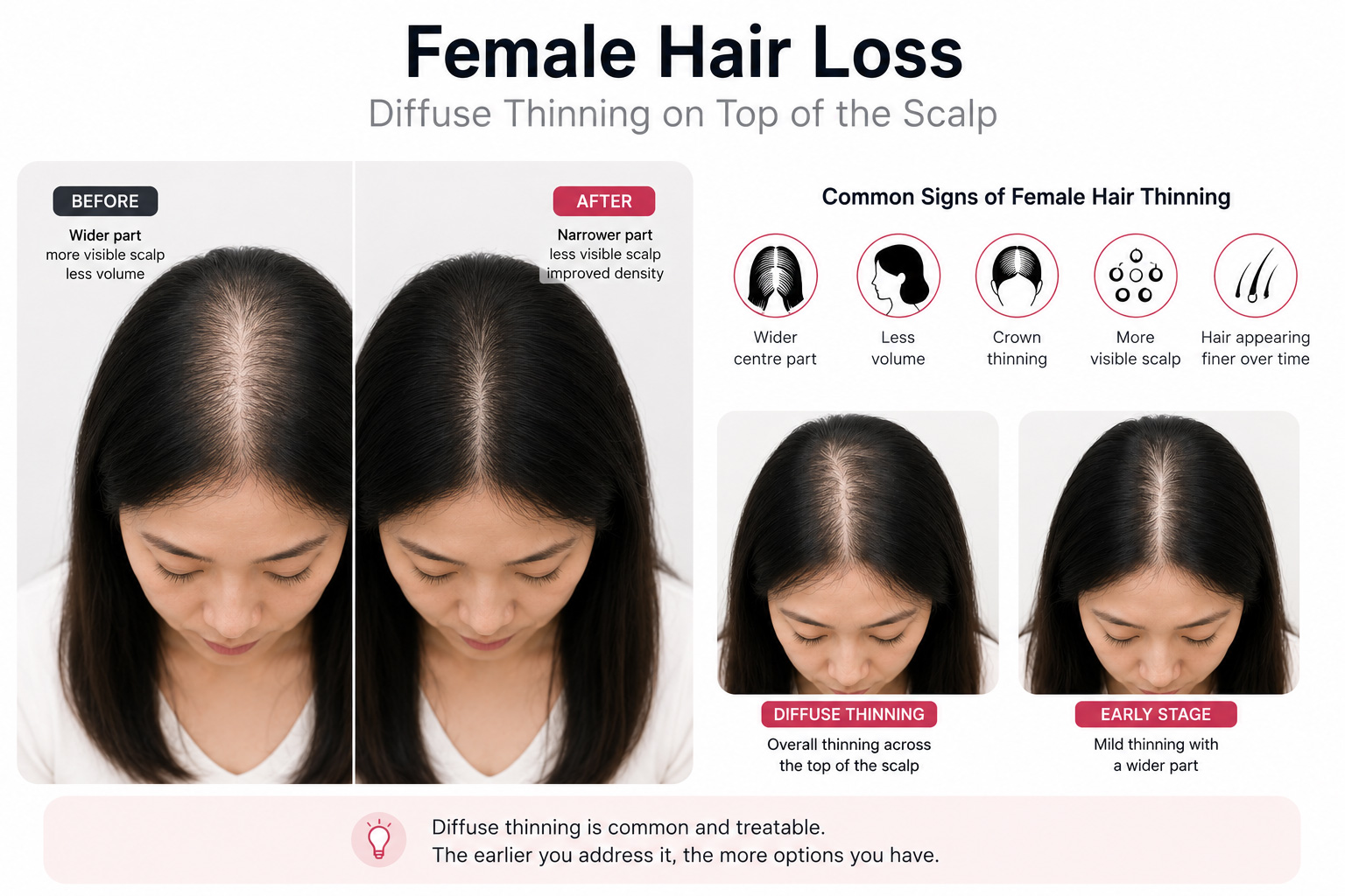 female-hair-loss