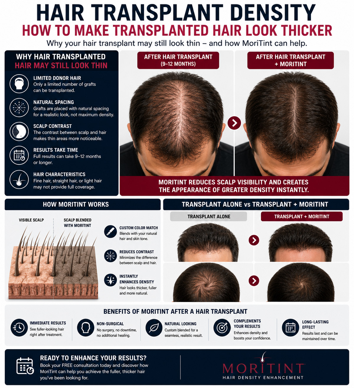 hair-transplant-density