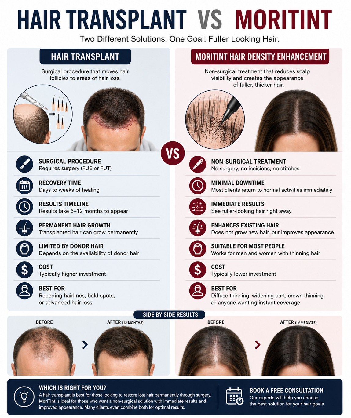 hair-transplant-vs-moritint
