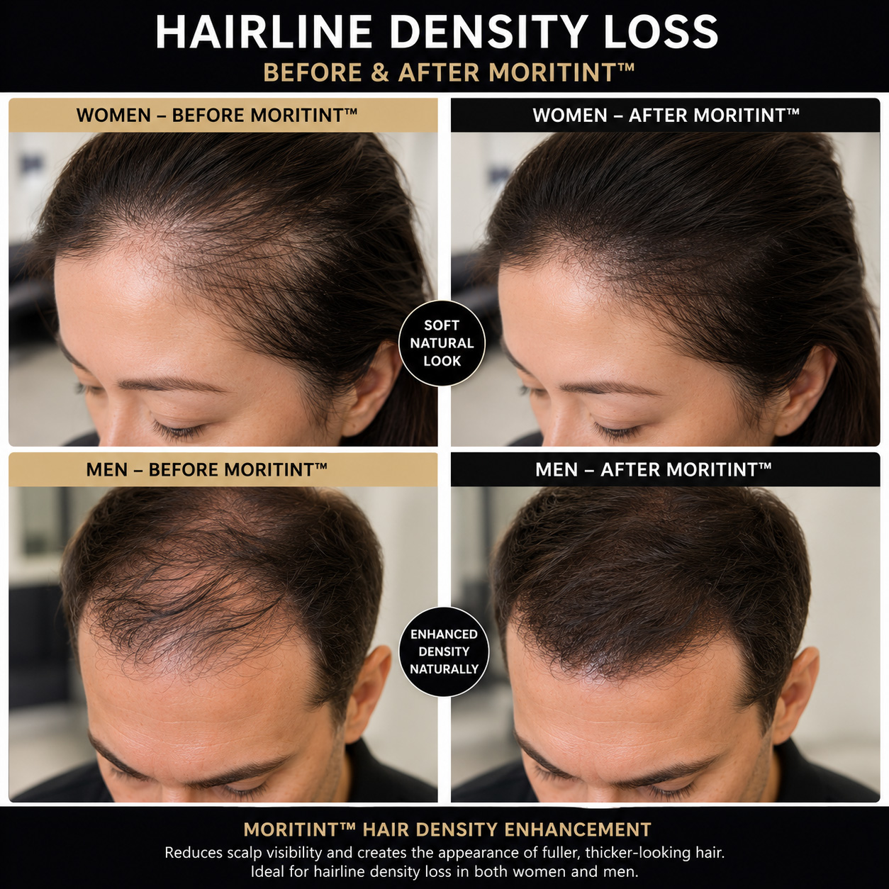 hairline-density-loss-solution