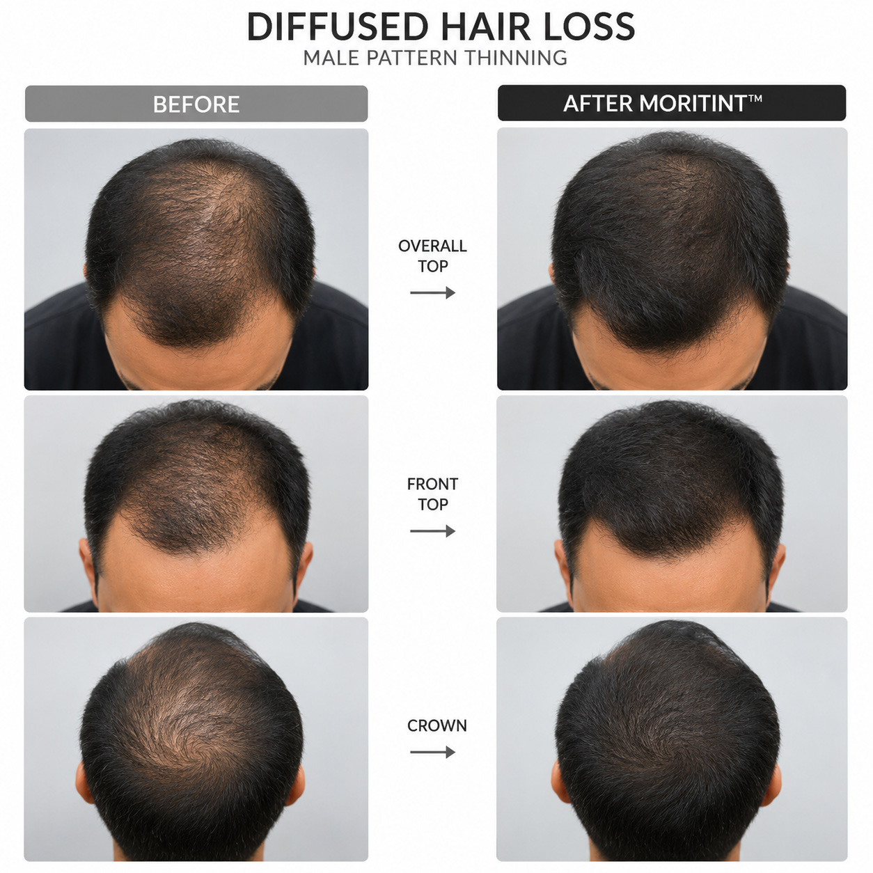 mens-hair-loss