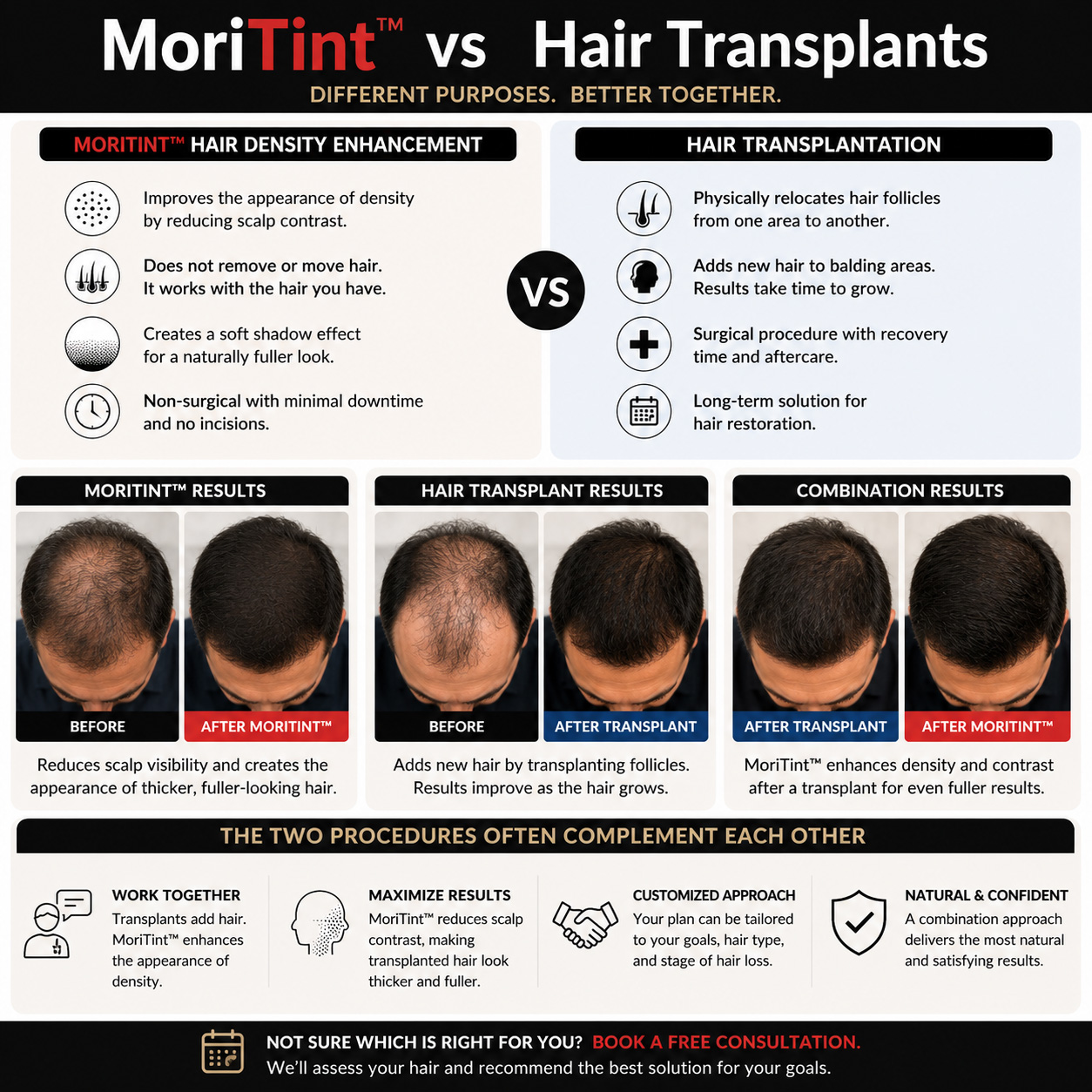 moritint-vs-hair-transplant
